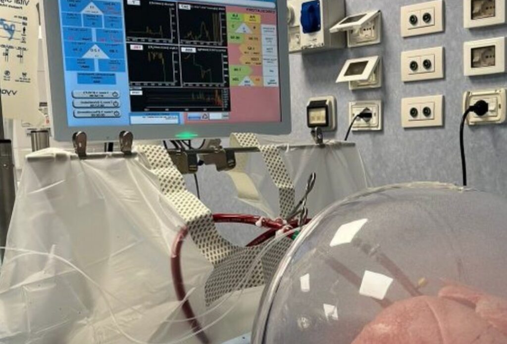 Al Policlinico di Milano una nuova tecnologia che rigenera i polmoni da trapiantare