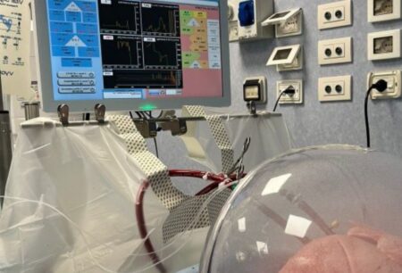 Al Policlinico di Milano una nuova tecnologia che rigenera i polmoni da trapiantare